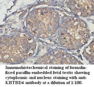 KBTBD4 Antibody (aa247-417)