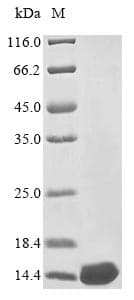 Vesicular Stomatitis Virus VSIV Protein C (Recombinant 6His, N-terminus)