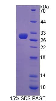 Human IFNAR2 Protein (Recombinant His)
