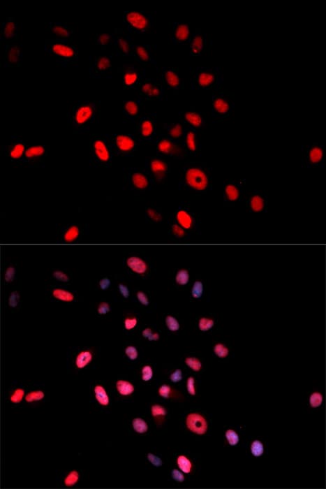 Polyclonal Rabbit anti-Human JUN / c-Jun Antibody (phospho-Ser63, IF, WB)