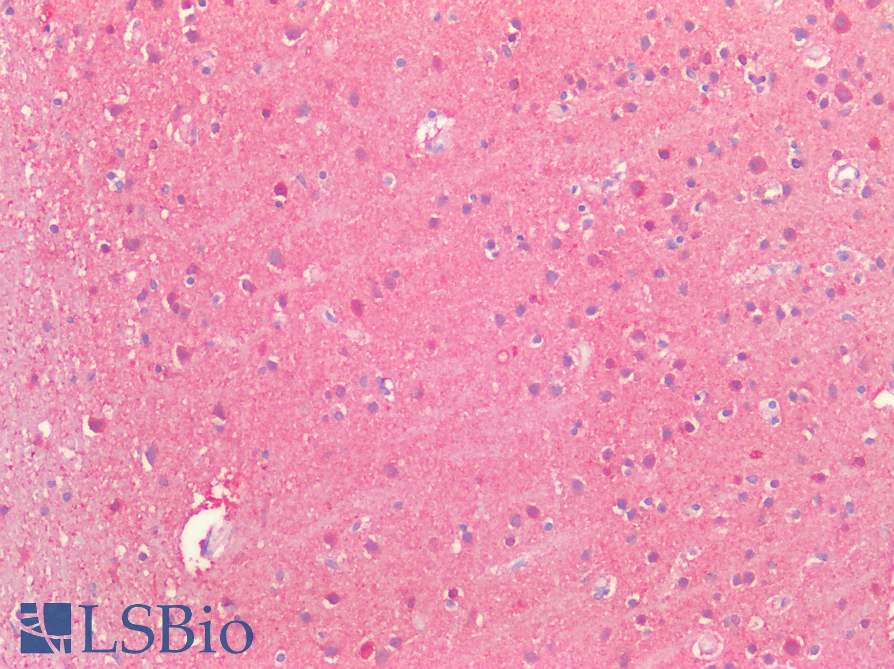 PathPlus™ Polyclonal Rabbit anti-Human SLC2A13 / HMIT / GLUT13 Antibody (aa268-297, IHC, WB)