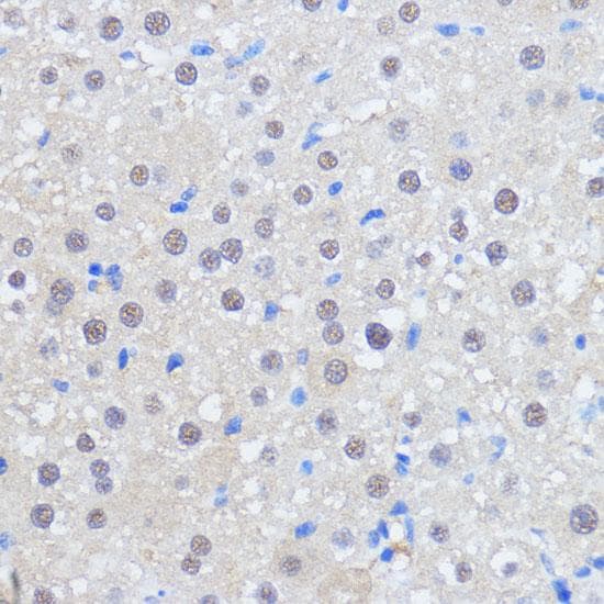 RBM39 Antibody