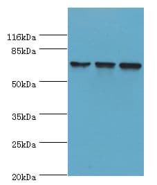 DDX3 / DDX3X Antibody (aa2-662, Biotin)