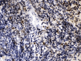 CIITA Antibody