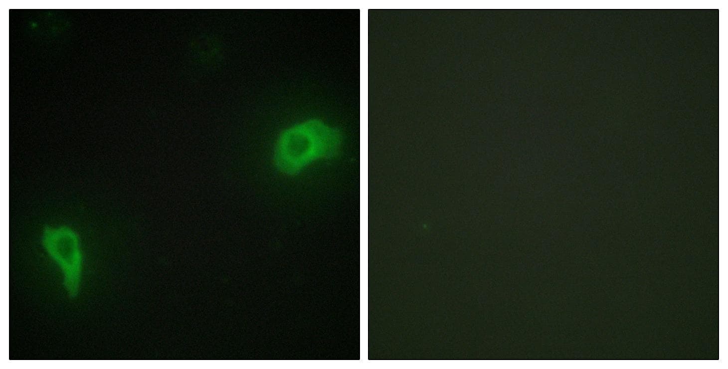 Polyclonal Rabbit anti-Human DOK7 Antibody (IHC, IF, WB)