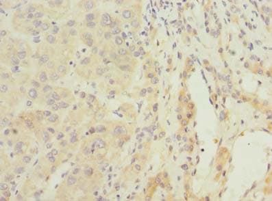 ARMCX2 Antibody