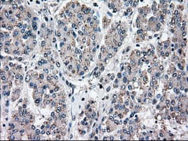 MAP2K4 / MKK4 Antibody (clone OTI1D6)