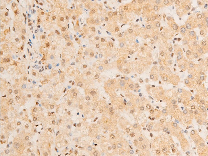 Polyclonal Rabbit anti-Human FOXO3 / FOXO3A Antibody (phospho-Ser253, IHC, WB)