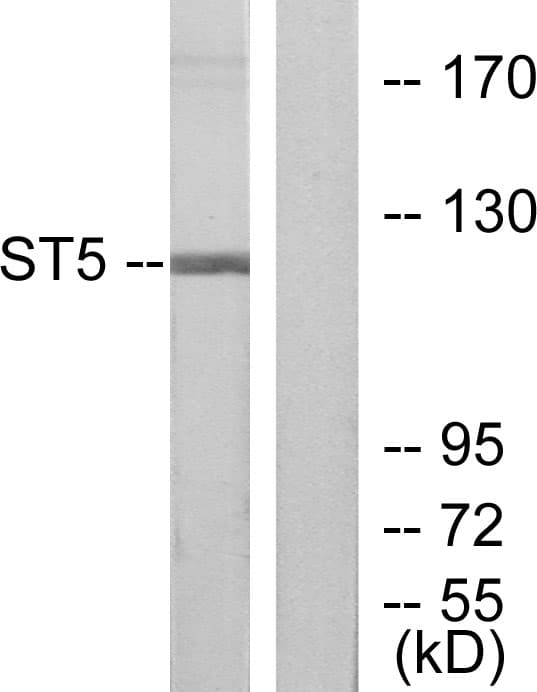 Polyclonal Rabbit anti-Human HTS1 / ST5 Antibody (aa411-460, WB)