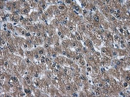 Monoclonal Mouse anti-Human AKR1A1 Antibody (clone OTI3C7, IHC, WB)