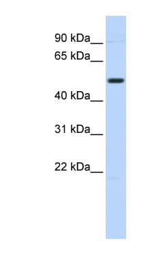 Polyclonal Rabbit anti-Human TRIM55 / MURF2 Antibody (aa72-121, WB)