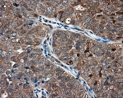 NIT1 Antibody (clone OTI4D12)