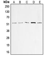 Polyclonal Rabbit anti-Human TP53 / p53 Antibody (N-Terminus, IHC, IF, WB)