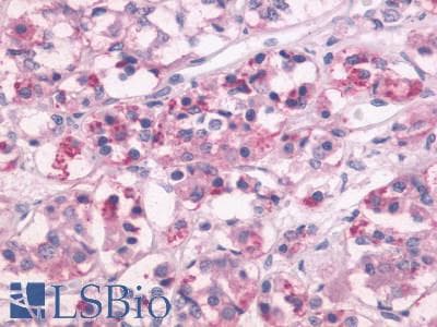 PathPlus™ DRD1 / Dopamine Receptor D1 Antibody (C-Terminus)