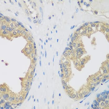 ENPEP / Aminopeptidase A Antibody