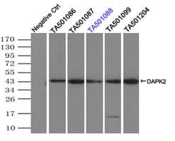 IHC-plus™ Monoclonal Mouse anti-Human DAPK2 / DAP Kinase 2 Antibody (clone 1B5, IHC, IF, WB)