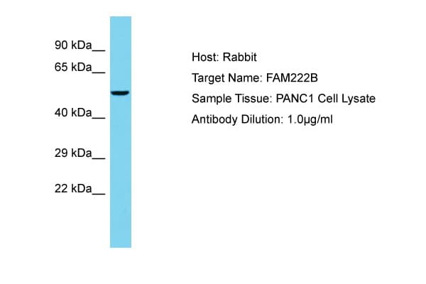 FAM222B Antibody (aa435-484)