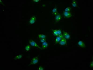 IHC-plus™ REG3A Antibody