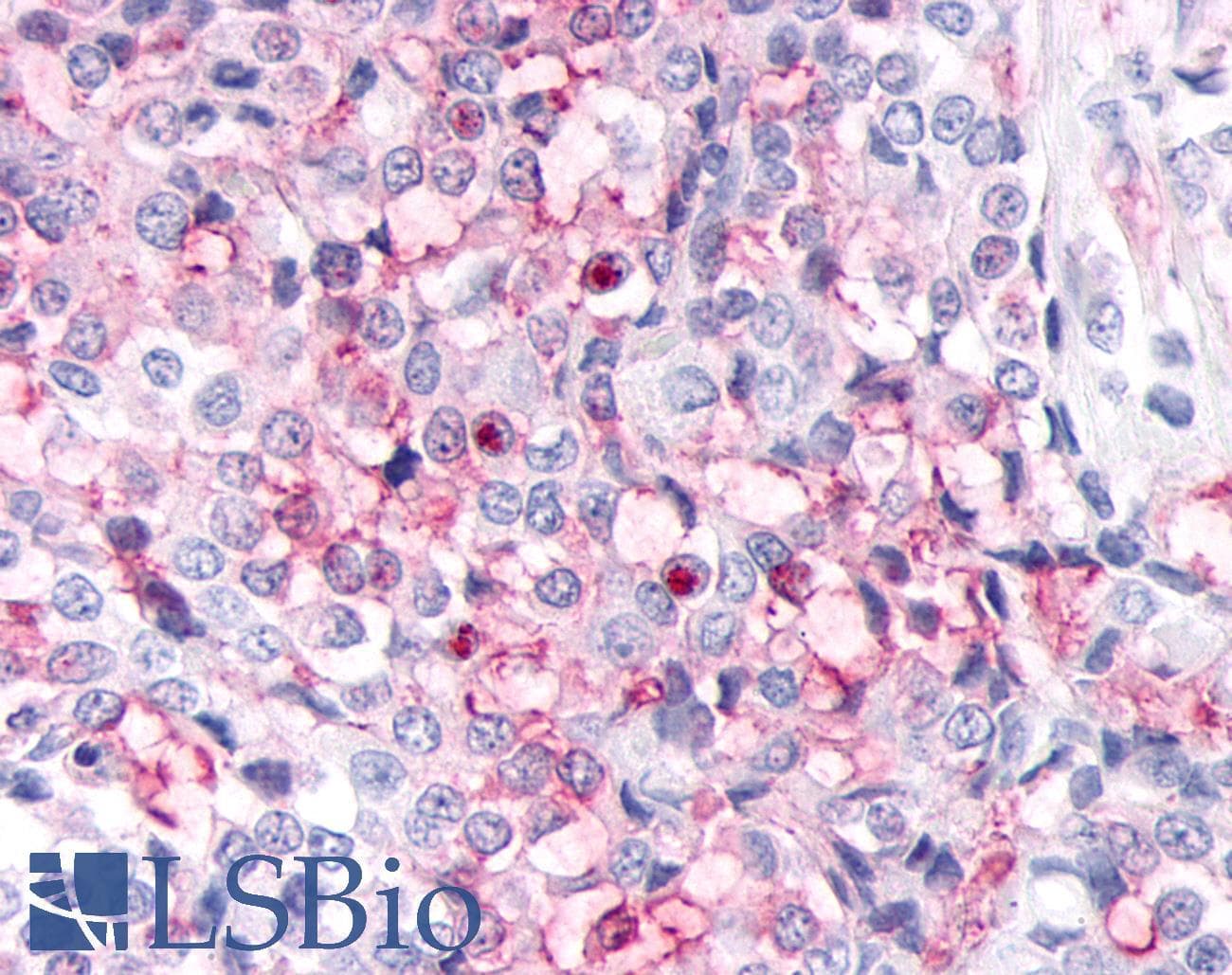 PathPlus™ Polyclonal Rabbit anti-Human ADAMTS4 Antibody (Disintegrin-like Domain, IHC)
