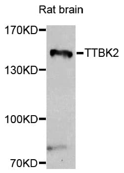 Polyclonal Rabbit anti-Human TTBK2 Antibody (IHC, IF, WB)