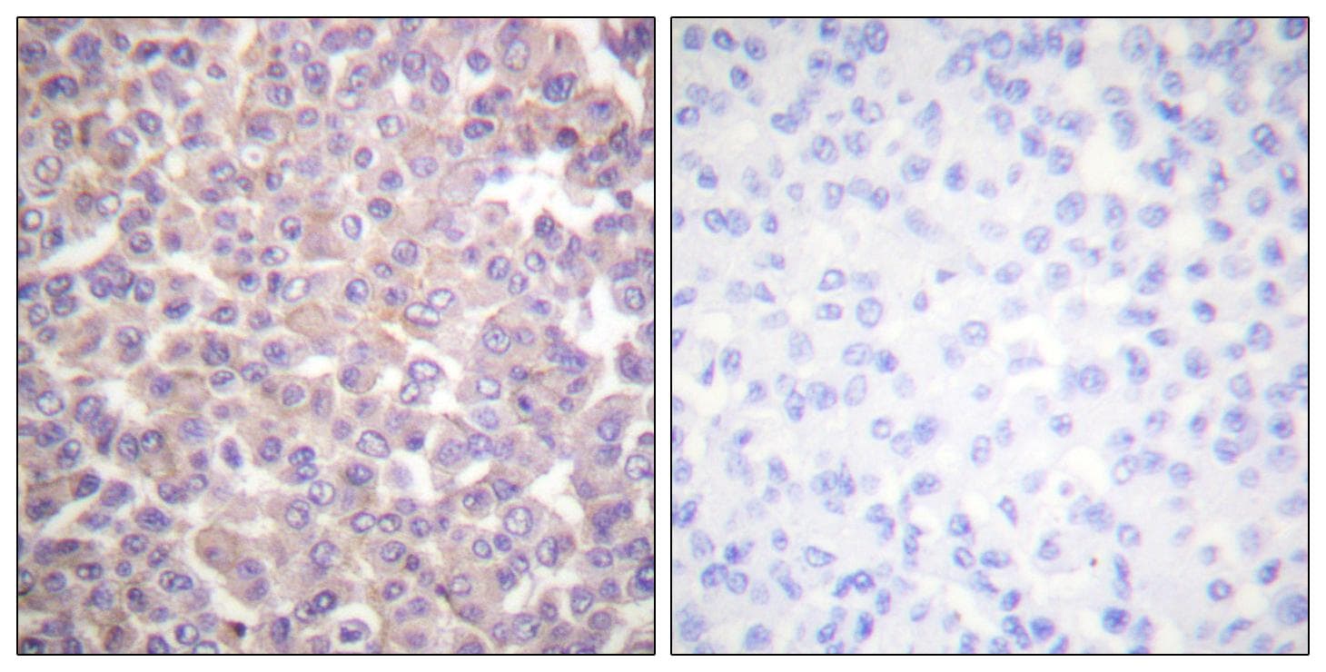 Polyclonal Rabbit anti-Human ERBB3 / HER3 Antibody (p1289, IHC, IF, WB)