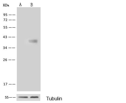 GALK1 / GK1 Antibody (Preservative Free)