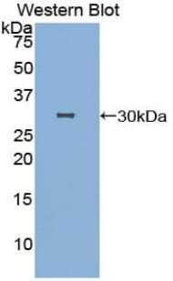 DFFB Antibody (aa87-323)