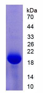 Mouse PIM1 / Pim-1 Protein (Recombinant His)