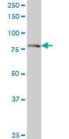 Monoclonal Mouse anti-Human DTX3L Antibody (clone 1D10, WB)