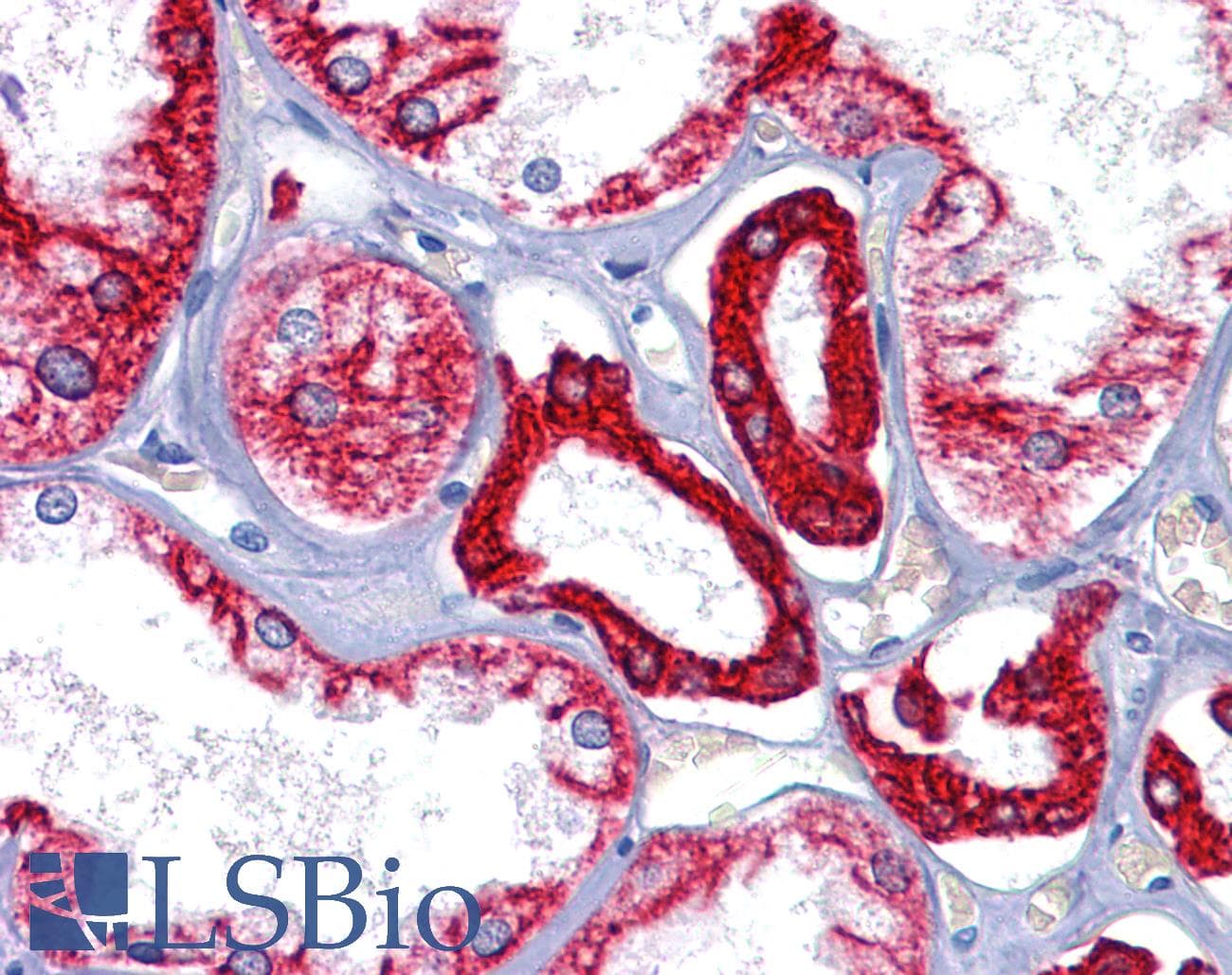 IHC-plus™ KRT8 / CK8 / Cytokeratin 8 Antibody (clone 8A5D12)
