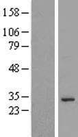 C17orf55 Protein (Over-Expression Lysate Myc-DDK (Flag))