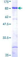 Human MAP3K8 / TPL2 Protein (Recombinant GST)