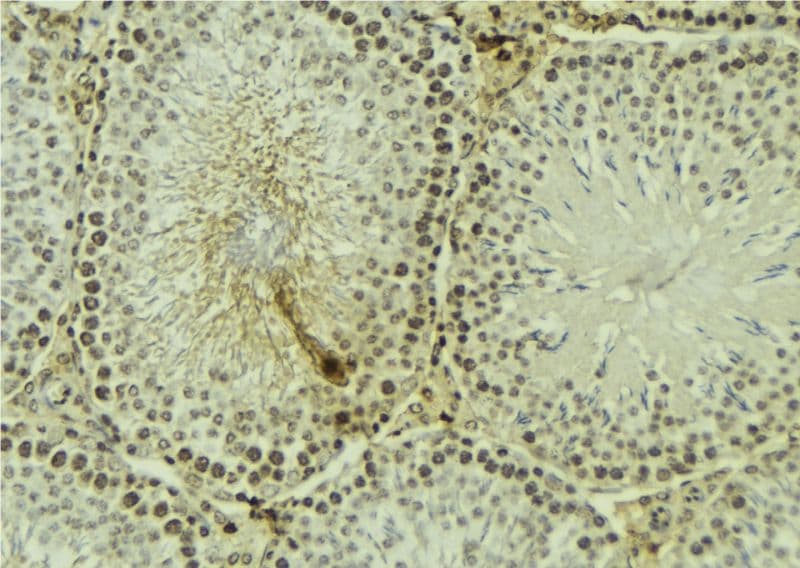 Polyclonal Rabbit anti-Human PRKCZ / PKC-Zeta Antibody (phospho-Thr560, IHC, IF, WB)