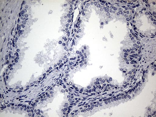 Monoclonal Mouse anti-Human SMC1A / SMC1 Antibody (clone OTI2D12, aa889-1016, IHC, WB)