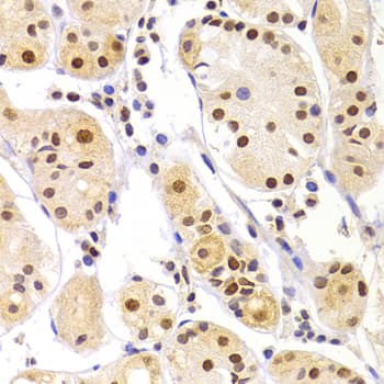 Polyclonal Rabbit anti-Human HNRPA1 / HnRNP A1 Antibody (IHC, IF, WB)