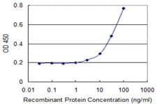 IHC-plus™ Monoclonal Mouse anti-Human AKR1B1 / Aldose Reductase Antibody (clone 2D12, IHC, WB)