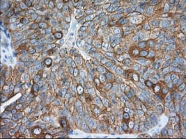 ERIC-1 / TACC3 Antibody (clone OTI1E4)