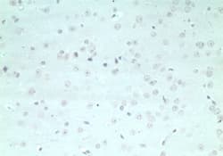 ARHGAP20 Antibody (aa570-620)