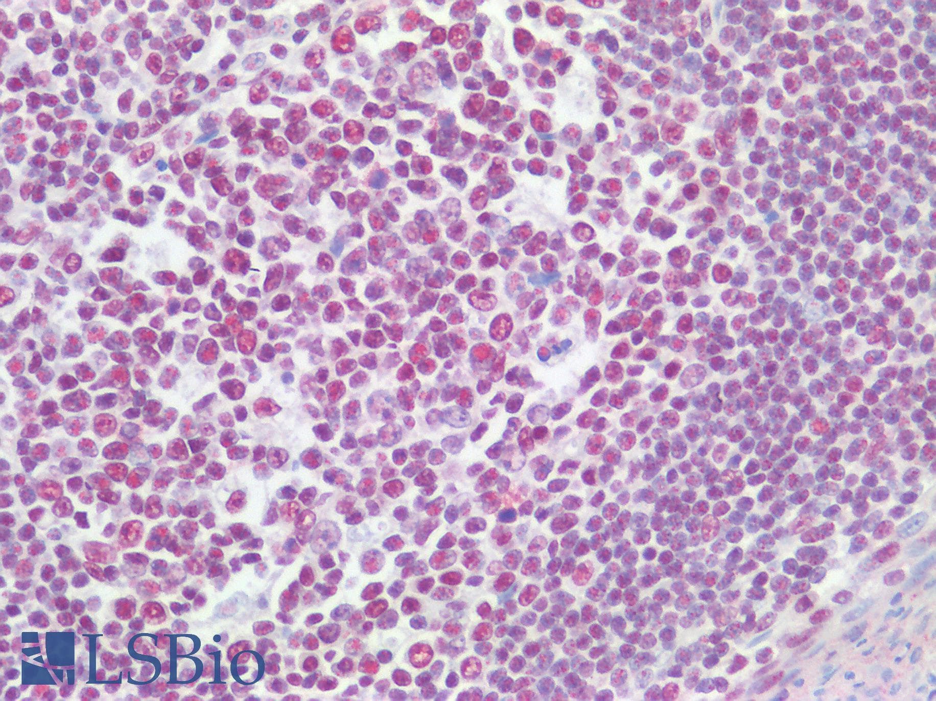 IHC-plus™ Polyclonal Rabbit anti-Human CSTF2 / CstF-64 Antibody (aa527-577, IHC)