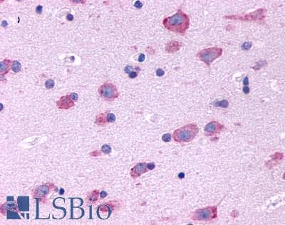 PathPlus™ HTR2B / 5-HT2B Receptor Antibody (N-Terminus)