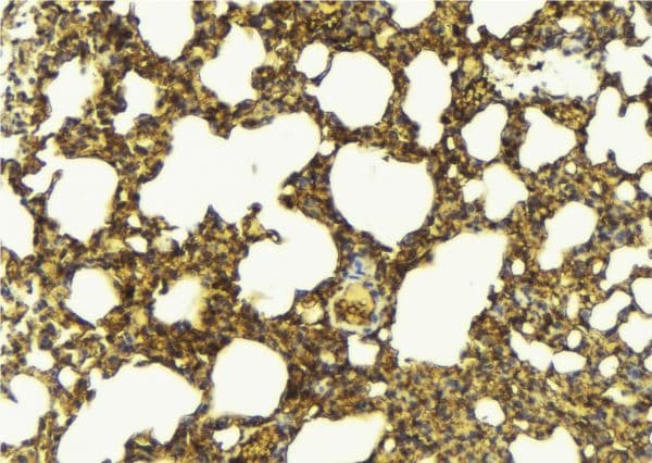 GGT1 / GGT Antibody