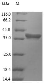 Arabidopsis thaliana HDT2 Protein (Recombinant 10His, N-terminus + Myc, C-terminus)