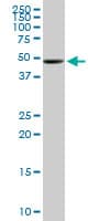 UGP2 Antibody (clone 3H3)