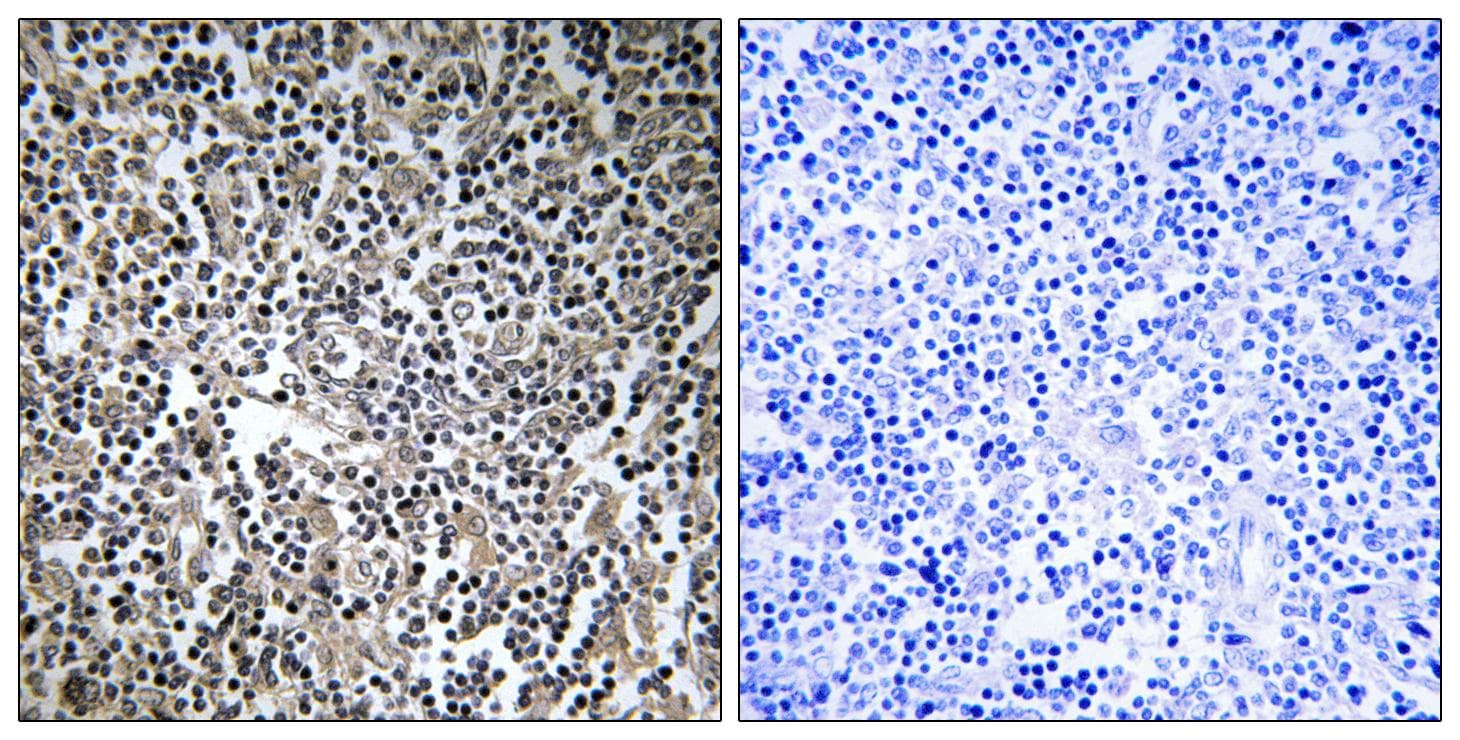 Polyclonal Rabbit anti-Human MPRIP / RIP3 Antibody (IHC)
