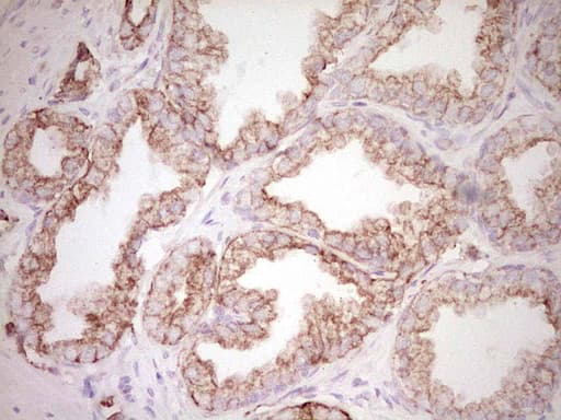 Monoclonal Mouse anti-Human Peripherin Antibody (clone OTI2D5, IHC, WB)