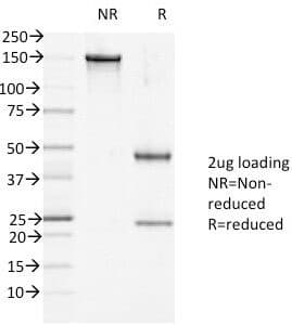 DSG1 / Desmoglein 1 Antibody (clone 27B2)