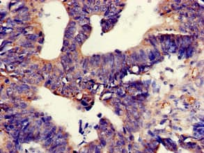 TNIK Antibody