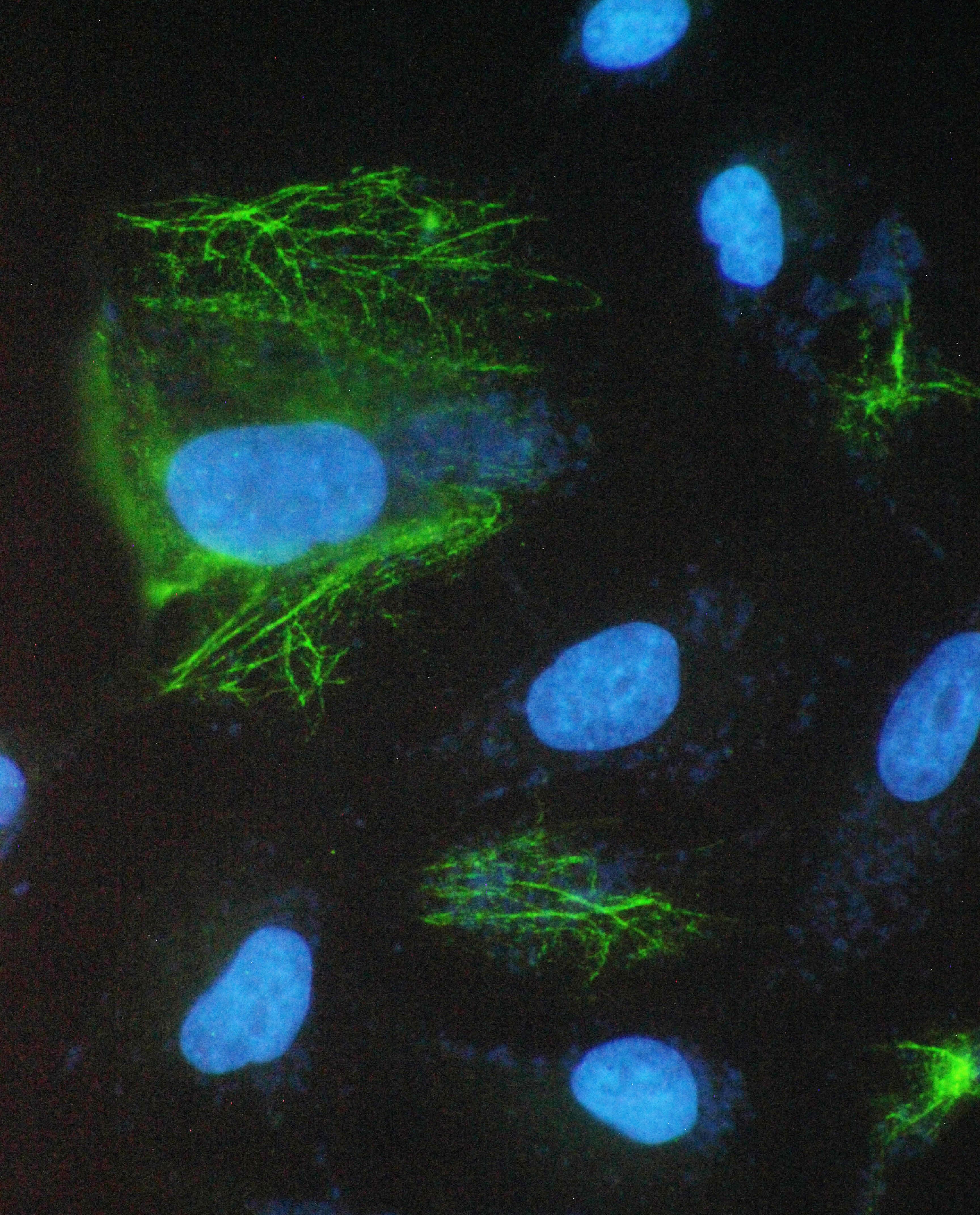 Polyclonal Rabbit anti-Human SCNN1A / ENaC Alpha Antibody (WB)