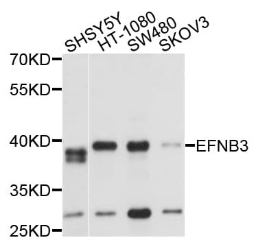 Polyclonal Rabbit anti-Human EFNB3 / Ephrin B3 Antibody (WB)