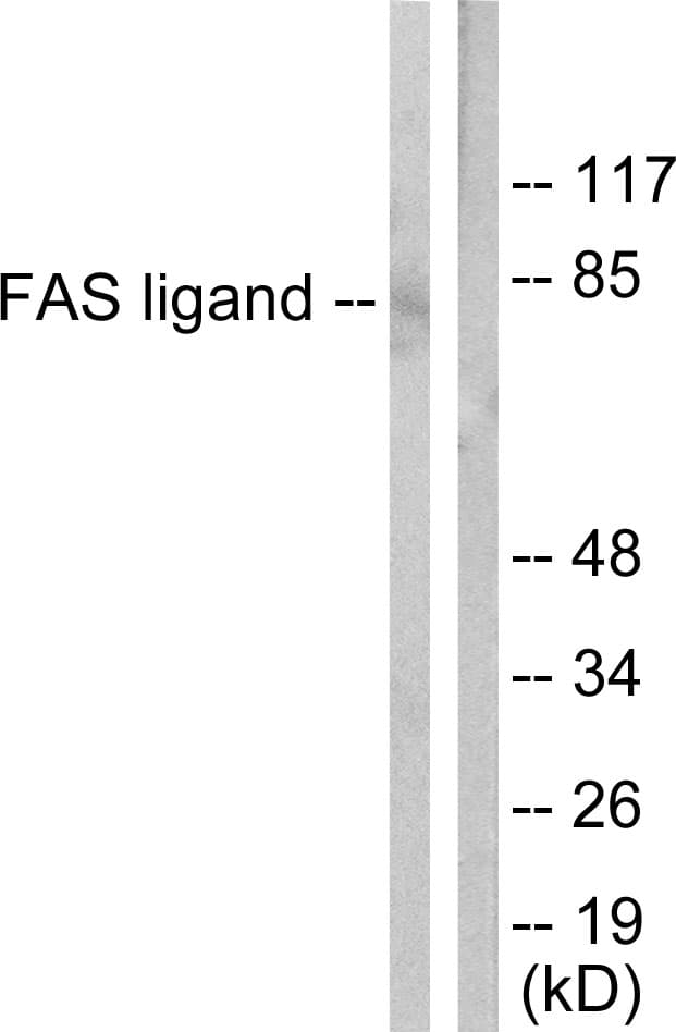 Polyclonal Rabbit anti-Human FASLG / Fas Ligand Antibody (aa101-150, IHC, WB)